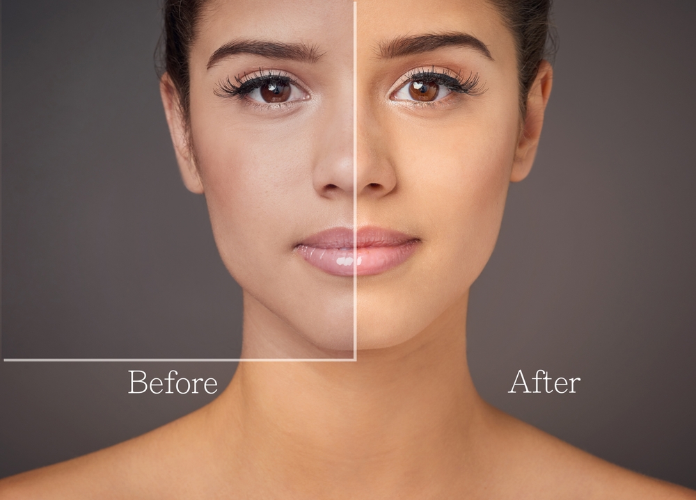 What Does a HydraFacial Do for Your Skin - hydrafacial in new orleans - thrive nola spa
