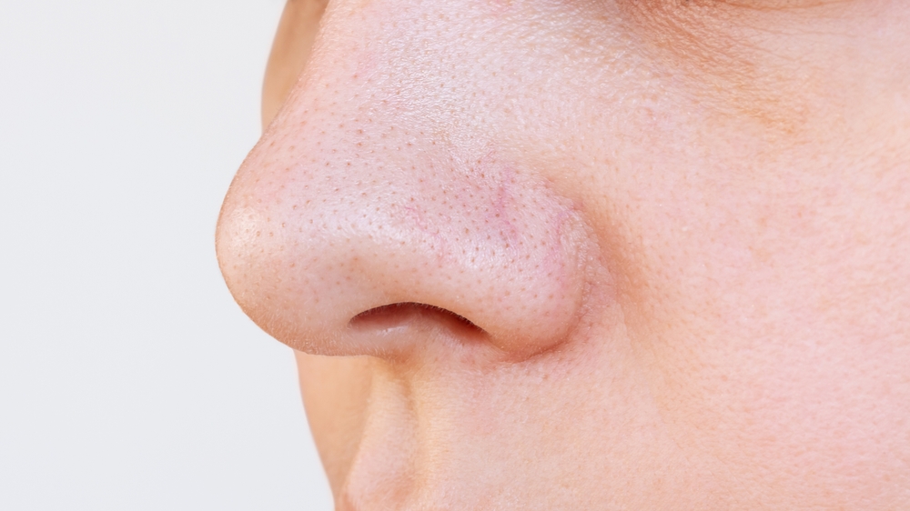 What Skin Problems Can a HydraFacial Help With - hydrafacial in new orleans - thrive nola spa