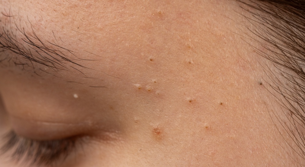 Can a Facial Help With Clogged Pores - facials in new orleans - thrive nola spa