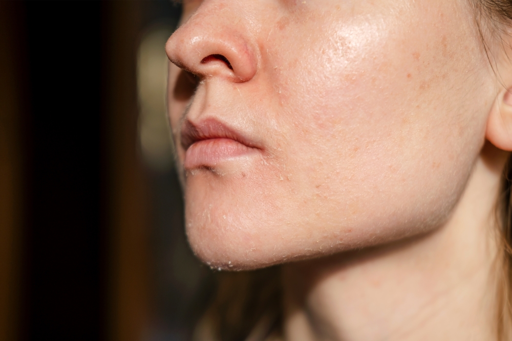 What Is the Best Facial for Dry or Dehydrated Skin - facials in new orleans - thrive nola spa